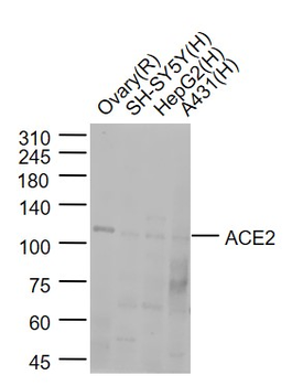 ACE2 Rabbit Polyclonal Antibody