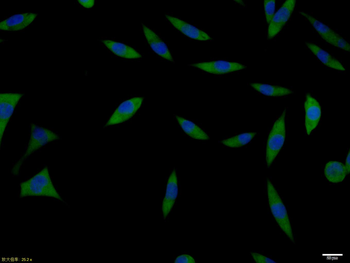 ACE2 Rabbit Polyclonal Antibody