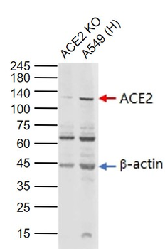 ACE2 Rabbit Polyclonal Antibody