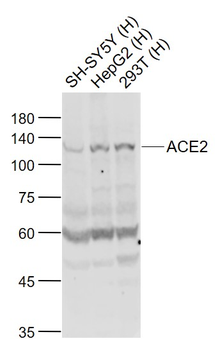 ACE2 Rabbit Polyclonal Antibody