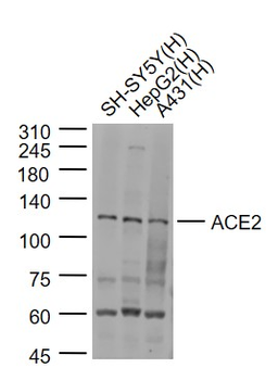 ACE2 Rabbit Polyclonal Antibody