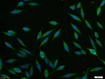 ACE2 Rabbit Polyclonal Antibody