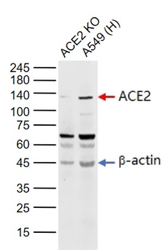 ACE2 Rabbit Polyclonal Antibody