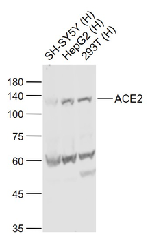 ACE2 Rabbit Polyclonal Antibody