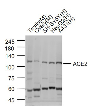ACE2 Rabbit Polyclonal Antibody