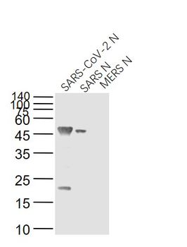 SARS-CoV Nucleocapsid Mouse Monoclonal Antibody
