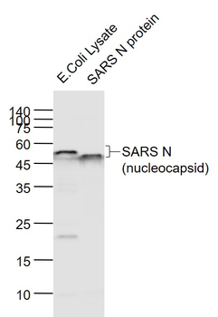 SARS-CoV Nucleocapsid Mouse Monoclonal Antibody