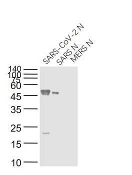 SARS-CoV Nucleocapsid Mouse Monoclonal Antibody