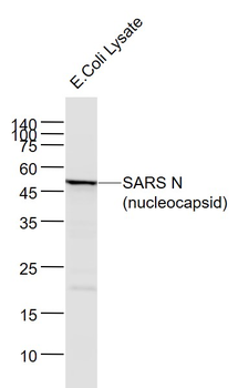SARS-CoV Nucleocapsid Mouse Monoclonal Antibody