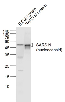 SARS-CoV Nucleocapsid Mouse Monoclonal Antibody