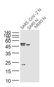 SARS-CoV Nucleocapsid Mouse Monoclonal Antibody
