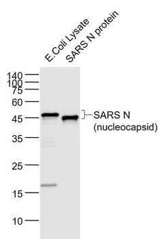 SARS-CoV Nucleocapsid Mouse Monoclonal Antibody
