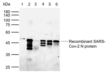 SARS-CoV-2 (2019-nCoV) Nucleocapsid Mouse Monoclonal Antibody