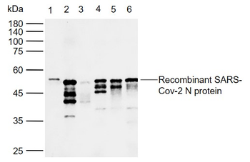 SARS-CoV-2 (2019-nCoV) Nucleocapsid Mouse Monoclonal Antibody