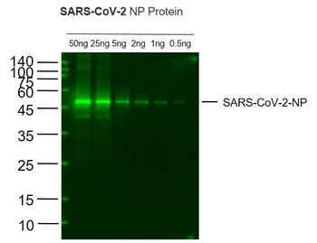 SARS-CoV-2 (2019-nCoV) Nucleocapsid Mouse Monoclonal Antibody