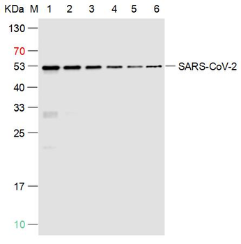 SARS-CoV-2 (2019-nCoV) Nucleocapsid Mouse Monoclonal Antibody