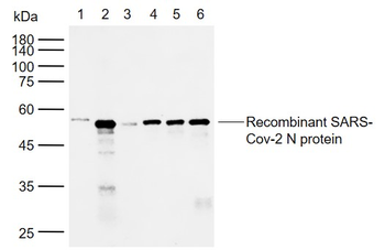 SARS-CoV-2 (2019-nCoV) Nucleocapsid Mouse Monoclonal Antibody