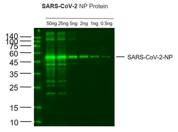 SARS-CoV-2 (2019-nCoV) Nucleocapsid Mouse Monoclonal Antibody