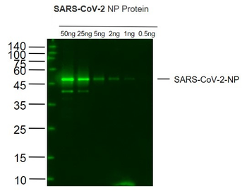SARS-CoV-2 (2019-nCoV) Nucleocapsid Mouse Monoclonal Antibody