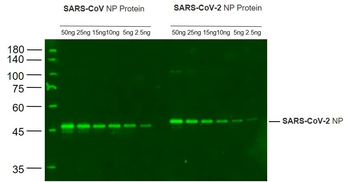 SARS-CoV-2 N protein Rabbit Polyclonal Antibody