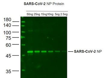 SARS-CoV-2 N protein Rabbit Polyclonal Antibody