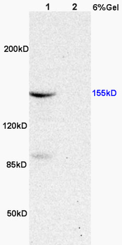 Phospho-ASK1 (Thr845) Rabbit Polyclonal Antibody