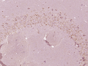 Phospho-MEK3 (Thr222) Rabbit Polyclonal Antibody