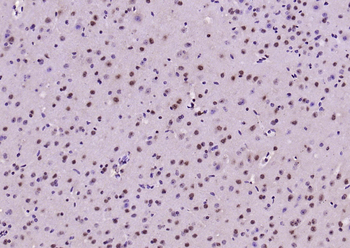 Phospho-MDM2 (Thr218) Rabbit Polyclonal Antibody