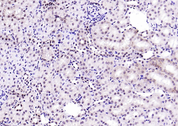 Phospho-MDM2 (Thr218) Rabbit Polyclonal Antibody