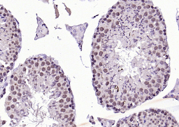 Phospho-MDM2 (Thr218) Rabbit Polyclonal Antibody