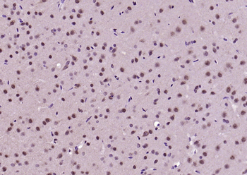 Phospho-MDM2 (Thr218) Rabbit Polyclonal Antibody