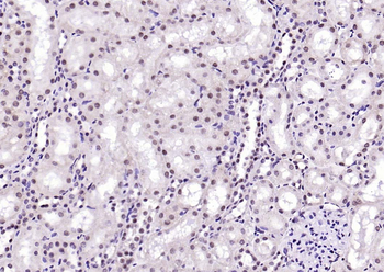 Phospho-MDM2 (Thr218) Rabbit Polyclonal Antibody