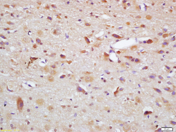 Phospho-MDM2 (Thr218) Rabbit Polyclonal Antibody