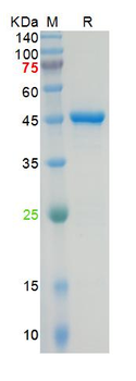 Recombinant SARS-Cov-2 N protein, N-His
