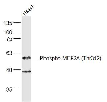 Phospho-MEF2A (Thr312) Rabbit Polyclonal Antibody