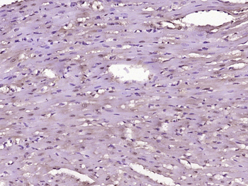 Phospho-MEF2A (Ser408) Rabbit Polyclonal Antibody