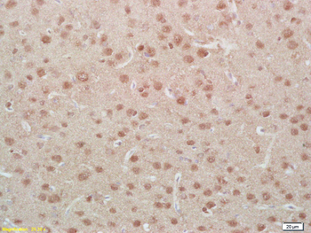 Phospho-MEF2A (Ser408) Rabbit Polyclonal Antibody