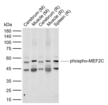 Phospho-MEF2C (Ser396) Rabbit Polyclonal Antibody