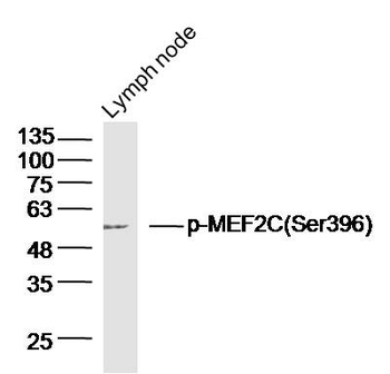 Phospho-MEF2C (Ser396) Rabbit Polyclonal Antibody
