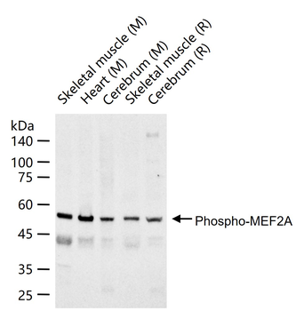 Phospho-MEF2A (Thr319) Rabbit Polyclonal Antibody