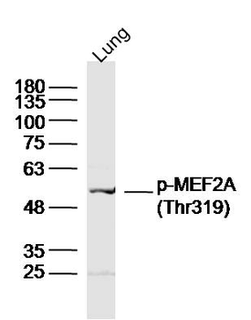 Phospho-MEF2A (Thr319) Rabbit Polyclonal Antibody