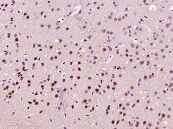 Phospho-MEF2C (Thr20) Rabbit Polyclonal Antibody