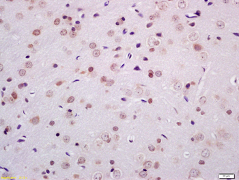 Phospho-MEF2C (Thr20) Rabbit Polyclonal Antibody