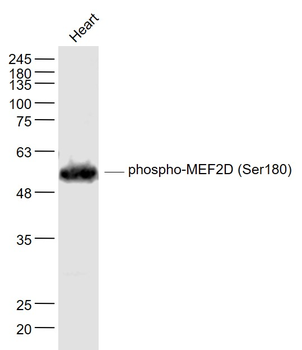 Phospho-MEF2D (Ser180) Rabbit Polyclonal Antibody
