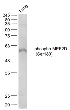 Phospho-MEF2D (Ser180) Rabbit Polyclonal Antibody