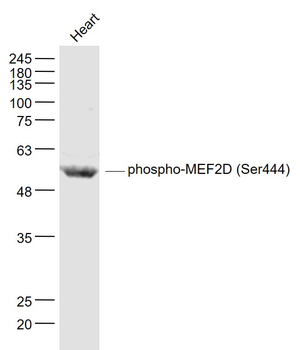 Phospho-MEF2D (Ser444) Rabbit Polyclonal Antibody