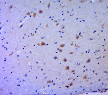 Phospho-MLK3 (Thr277 + Ser281) Rabbit Polyclonal Antibody