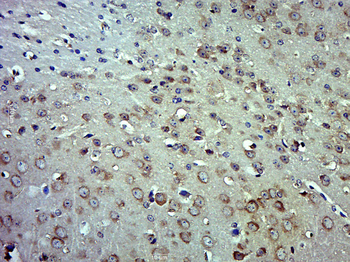 Phospho-MLK3 (Thr277 + Ser281) Rabbit Polyclonal Antibody