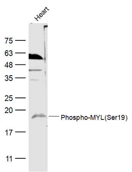 Phospho-MYL (Ser19) Rabbit Polyclonal Antibody