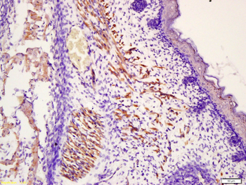 MYL3 Rabbit Polyclonal Antibody